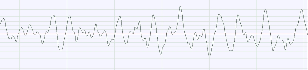 La courbe de fréquence est ici le résultat de la superposition de toutes les fréquences de la musique.